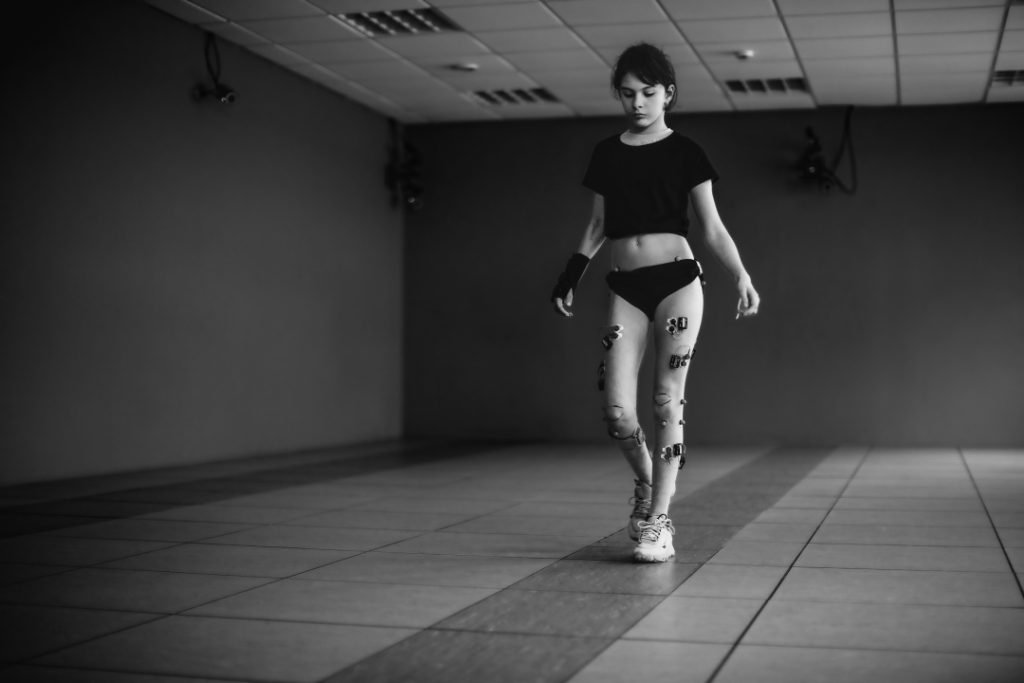 Pediatric Gait Analysis using Qualisys Miqus motion capture cameras and EMG